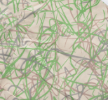 The Calderon Textiles 100% MJS Poly Patient Gown features a beige fabric with an abstract pattern of overlapping green, brown, and gray scribbles and lines.