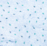 The light blue textured fabric of the Calderon Textiles 100% MJS Poly Patient Gown features dark blue and teal leaf-like shapes, with Color Lock technology ensuring lasting vibrancy—perfect for comfortable, durable gowns.