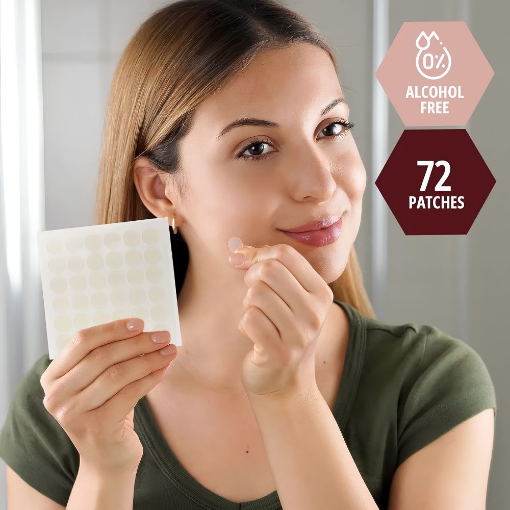 A woman in a green shirt smiles while applying a Shield Line Medpride Hydrocolloid Acne Patch (12mm) to her face. Beside her, text reads "Alcohol-Free" and "72 Patches.