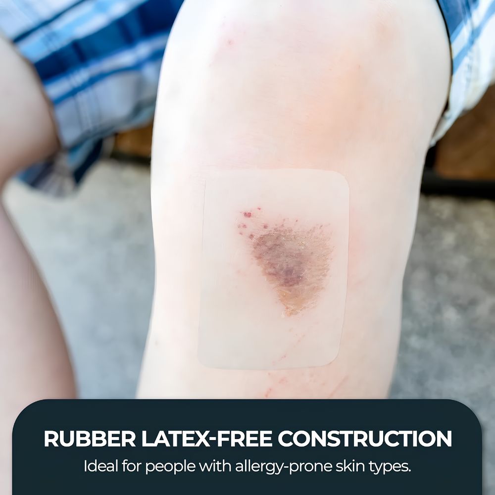 A person’s scraped knee is protected by Shield Line MedPride Transparent Film (4’’x5’’ & 6’’x8’’) Wound Dressing. Text at the bottom: Rubber latex-free—ideal for allergy-prone skin types.